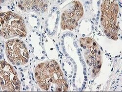ACY1 Monoclonal Antibody (OTI1B12), TrueMAB , OriGene 30 &mu;L; Unconjugated:Antibodies,