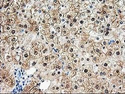 ACY1 Monoclonal Antibody (OTI1B12), TrueMAB , OriGene 30 &mu;L; Unconjugated:Antibodies,