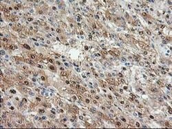ACY1 Monoclonal Antibody (OTI1B12), TrueMAB , OriGene:Antibodies:Primary
