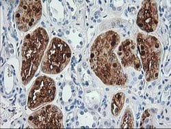 ACY1 Monoclonal Antibody (OTI16C1), TrueMAB , OriGene:Antibodies:Primary