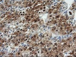 ACY1 Mouse anti-Human, Clone: OTI16C1, lyophilized, TrueMAB 100 &mu;g;