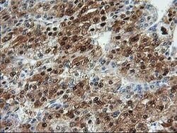 ACY1 Monoclonal Antibody (OTI16C1), TrueMAB , OriGene 30 &mu;L; Unconjugated:Antibodies,