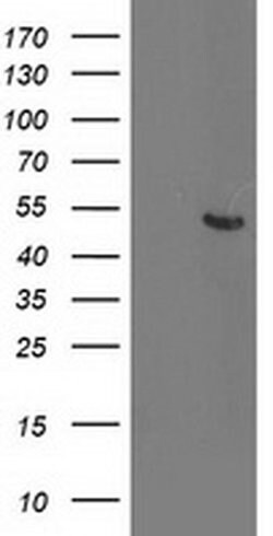 ACY1 Monoclonal Antibody (OTI2B5), TrueMAB , OriGene:Antibodies:Primary