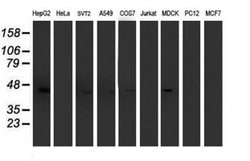 ACY1 Monoclonal Antibody (OTI2F1), TrueMAB , OriGene 100 &mu;L; Unconjugated:Antibodies,