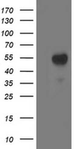 ACY1 Monoclonal Antibody (OTI1A12), TrueMAB , OriGene 100 &mu;L; Unconjugated:Antibodies,
