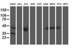 ACY1 Monoclonal Antibody (OTI1A12), TrueMAB , OriGene 100 &mu;L; Unconjugated:Antibodies,