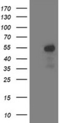ACY1 Mouse anti-Canine, Human, Mouse, Rat, Clone: OTI1B12, lyophilized,