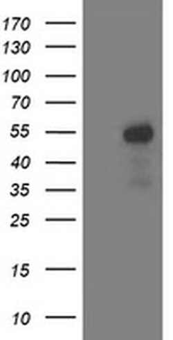 ACY1 Monoclonal Antibody (OTI1B12), TrueMAB , OriGene:Antibodies:Primary