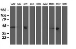 ACY1 Monoclonal Antibody (OTI1B12), TrueMAB , OriGene 30 &mu;L; Unconjugated:Antibodies,