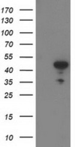 ACY1 Mouse anti-Human, Clone: OTI1H9, lyophilized, TrueMAB 100 &mu;g; Unconjugated:Antibodies,