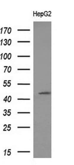 ACY1 Monoclonal Antibody (OTI1H9), TrueMAB , OriGene 30 &mu;L | Buy Online | Origene Technologies | Fisher Scientific