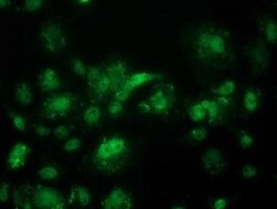ACY3 Mouse anti-Human, Clone: OTI2D5, lyophilized, TrueMAB 100 &mu;g; Unconjugated:Antibodies,