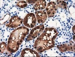 ACY3 Monoclonal Antibody (OTI4C1), TrueMAB , OriGene 100 &mu;L; Unconjugated:Antibodies,