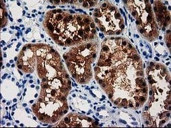 ACY3 Mouse anti-Human, Clone: OTI2D5, lyophilized, TrueMAB 100 &mu;g; Unconjugated:Antibodies,