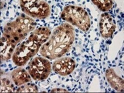 ACY3 Monoclonal Antibody (OTI2F1), TrueMAB , OriGene 100 &mu;L; Unconjugated:Antibodies,
