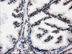 ACY3 Monoclonal Antibody (OTI4H7), TrueMAB , OriGene 100 &mu;L; Unconjugated:Antibodies,