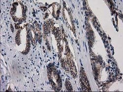 ACY3 Monoclonal Antibody (OTI4H7), TrueMAB , OriGene 100 &mu;L; Unconjugated:Antibodies,