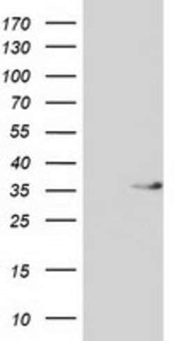 ACY3 Mouse anti-Human, Clone: OTI3A1, lyophilized, TrueMAB 100 &mu;g; Unconjugated:Antibodies,