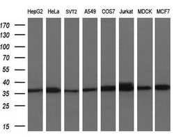 ACY3 Mouse anti-Human, Clone: OTI3A1, lyophilized, TrueMAB 100 &mu;g; Unconjugated:Antibodies,