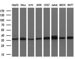 ACY3 Monoclonal Antibody (OTI3A1), TrueMAB , OriGene 30 &mu;L; Unconjugated:Antibodies,