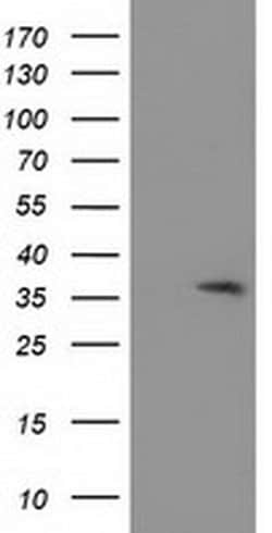 ACY3 Monoclonal Antibody (OTI4C1), TrueMAB , OriGene 100 &mu;L; Unconjugated:Antibodies,