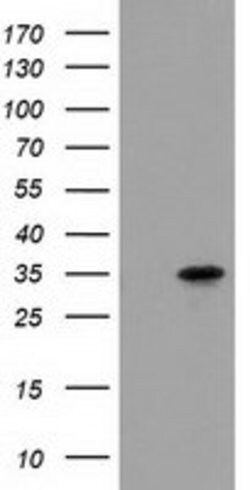 ACY3 Mouse anti-Human, Clone: OTI2D5, lyophilized, TrueMAB 100 &mu;g; Unconjugated:Antibodies,
