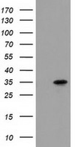 ACY3 Monoclonal Antibody (OTI2D5), TrueMAB , OriGene 100 &mu;L; Unconjugated:Antibodies,