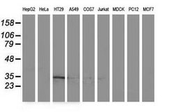 ACY3 Mouse anti-Human, Clone: OTI2D5, lyophilized, TrueMAB 100 &mu;g; Unconjugated:Antibodies,