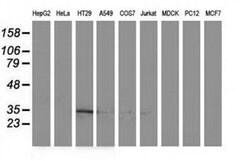 ACY3 Monoclonal Antibody (OTI2D5), TrueMAB , OriGene 100 &mu;L; Unconjugated:Antibodies,
