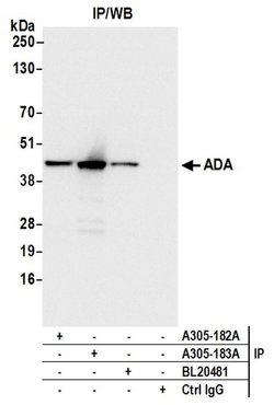 ADA/Adenosine Deaminase Rabbit anti-Human, Polyclonal, Bethyl Laboratories