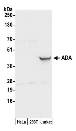 ADA/Adenosine Deaminase Rabbit anti-Human, Polyclonal, Bethyl Laboratories