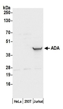 ADA/Adenosine Deaminase Polyclonal Antibody, Bethyl Laboratories:Antibodies:Primary