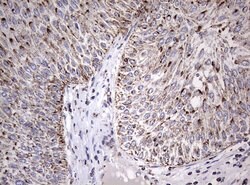 ADAMTS1 Monoclonal Antibody (OTI4H2), TrueMAB , OriGene 100 &mu;L; Unconjugated:Antibodies,