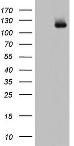 ADAMTS1 Monoclonal Antibody (OTI1B4), TrueMAB , OriGene 30 &mu;L; Unconjugated:Anticuerpos