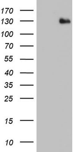 ADAMTS1 Monoclonal Antibody (OTI4H2), TrueMAB , OriGene 100 &mu;L; Unconjugated:Antibodies,