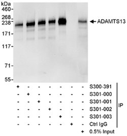 ADAMTS13 Goat anti-Human, Polyclonal, Bethyl Laboratories 100 &mu;L; Unconjugated:Antibodies,