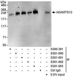 ADAMTS13 Goat anti-Human, Polyclonal, Bethyl Laboratories 100 &mu;L; Unconjugated:Antibodies,