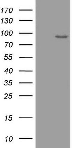 ADAMTS4 Mouse anti-Human, Clone: OTI2G8, lyophilized, TrueMAB 100 &mu;g;