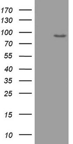 ADAMTS4 Monoclonal Antibody (OTI2G8), TrueMAB , OriGene:Antibodies:Primary