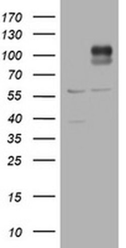 ADAMTS8 Monoclonal Antibody (OTI2A5), TrueMAB , OriGene:Antibodies:Primary