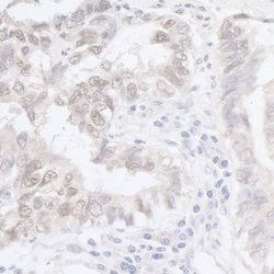 ADAR1 Rabbit anti-Human, Polyclonal, Bethyl Laboratories 100 &mu;L; Unconjugated:Antibodies,