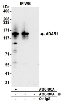 ADAR1 Rabbit anti-Human, Polyclonal, Bethyl Laboratories 100 &mu;L; Unconjugated:Antibodies,