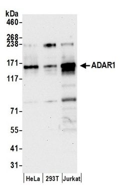 ADAR1 Rabbit anti-Human, Polyclonal, Bethyl Laboratories 100 &mu;L; Unconjugated:Antibodies,
