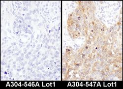 ADE2 Rabbit anti-Human, Mouse, Polyclonal, Bethyl Laboratories 100 &mu;L;