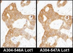 ADE2 Rabbit anti-Human, Mouse, Polyclonal, Bethyl Laboratories 100 &mu;L;