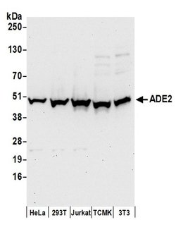 ADE2 Rabbit anti-Human, Mouse, Polyclonal, Bethyl Laboratories 100 &mu;L;