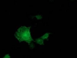 ADH1B Mouse anti-Human, Clone: OTI1C3, lyophilized, TrueMAB 100 &mu;g;