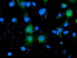 ADH1B Monoclonal Antibody (OTI1H7), TrueMAB , OriGene 30 &mu;L; Unconjugated:Antibodies,