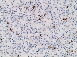 ADH1B Mouse anti-Human, Clone: OTI1C3, lyophilized, TrueMAB 100 &mu;g;