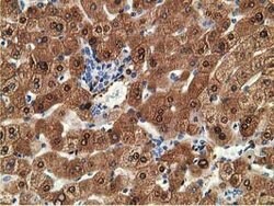 ADH1B Mouse anti-Human, Clone: OTI1C3, lyophilized, TrueMAB 100 &mu;g;